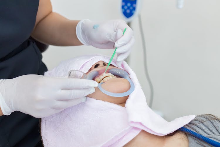 マウストレーの作成